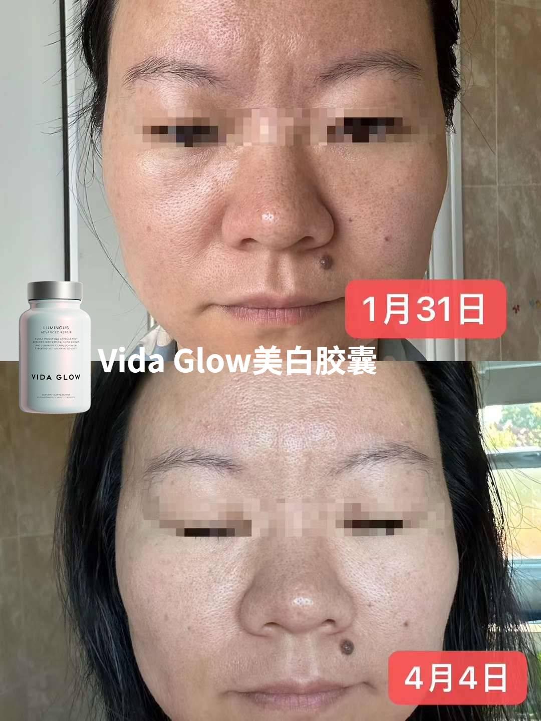 一文搞懂Vida Glow滤镜胶囊